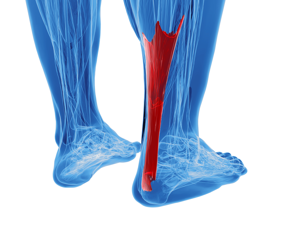 treating achilles tendonitis