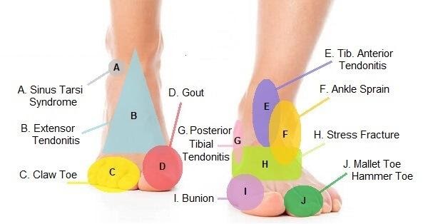 common causes of foot pain2