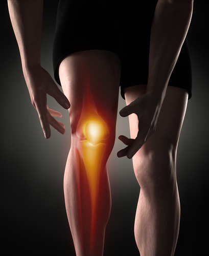 patellofemoral pain syndrome