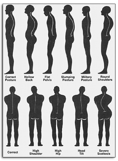 posture chart