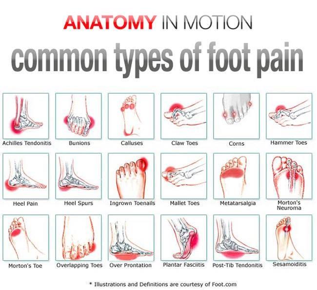 What Are The Common Causes Of Foot Pain?