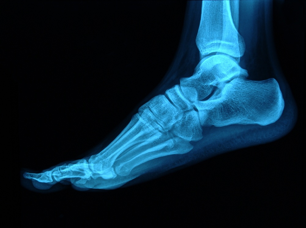 Three Common Areas Of The Foot That Can Have Chronic Pain