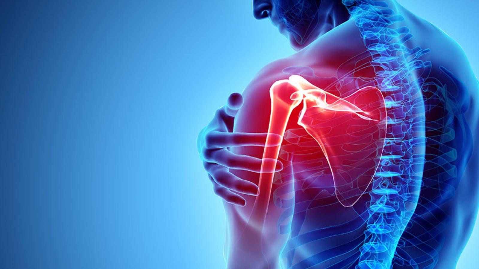 Posterior Shoulder Pain And How To Relieve It