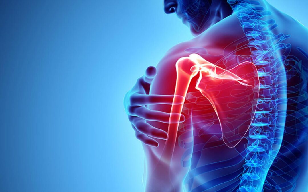 Posterior Shoulder Pain And How To Relieve It